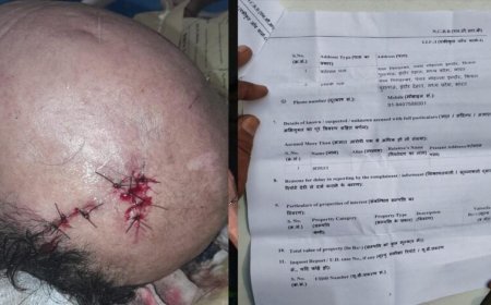 अधिमान्य पत्रकार नेतृत्व समिति के प्रदेश कार्यवाहक अध्यक्ष पर प्राण घातक हमला
